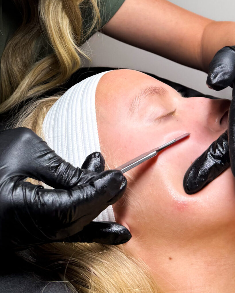 dermaplaning facial in idaho falls