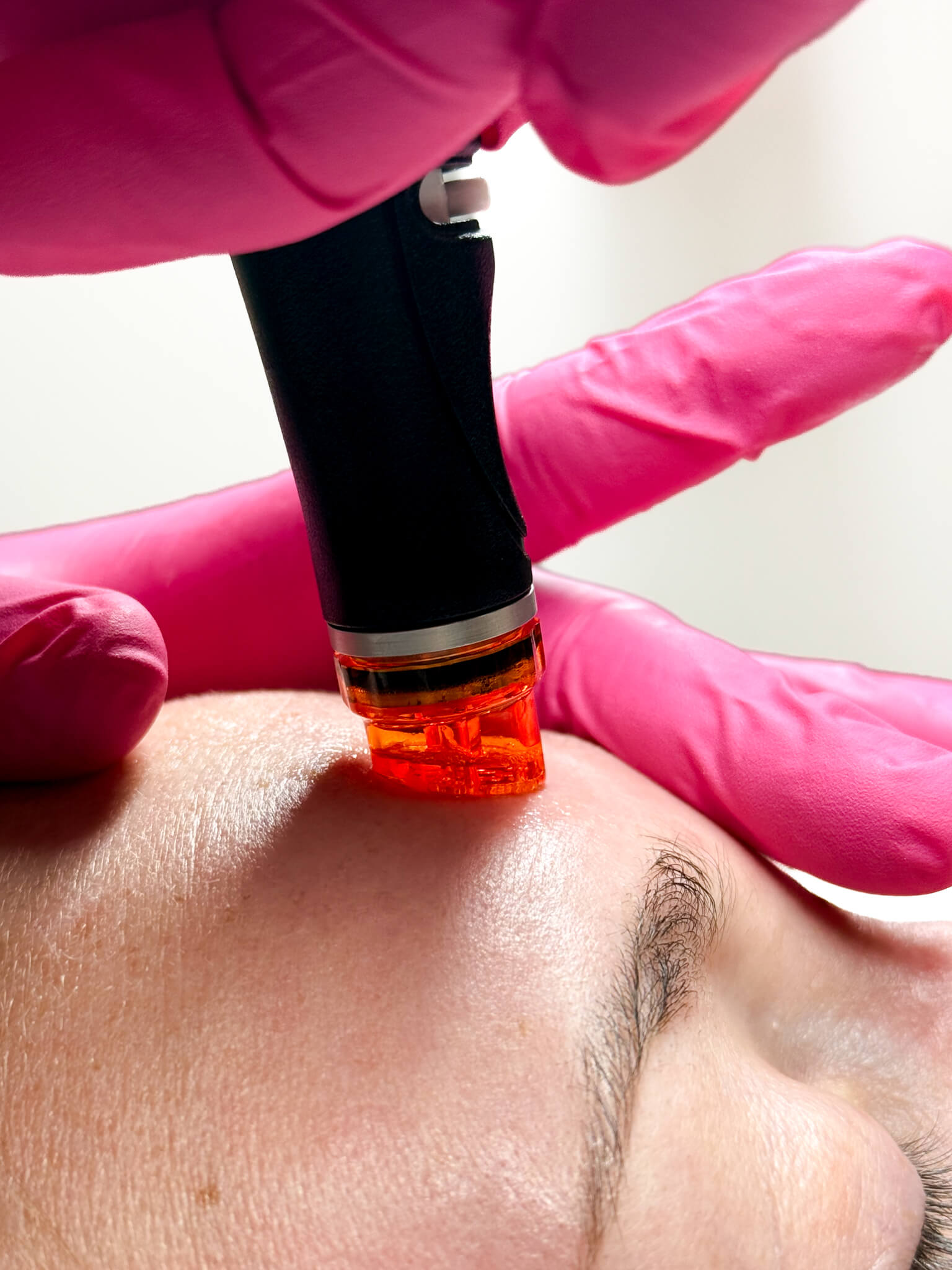 hydrafacial cleanse medical spa idaho falls